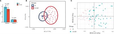 Gut Microbiome Was Highly Related to the Regulation of Metabolism in Lung Adenocarcinoma Patients